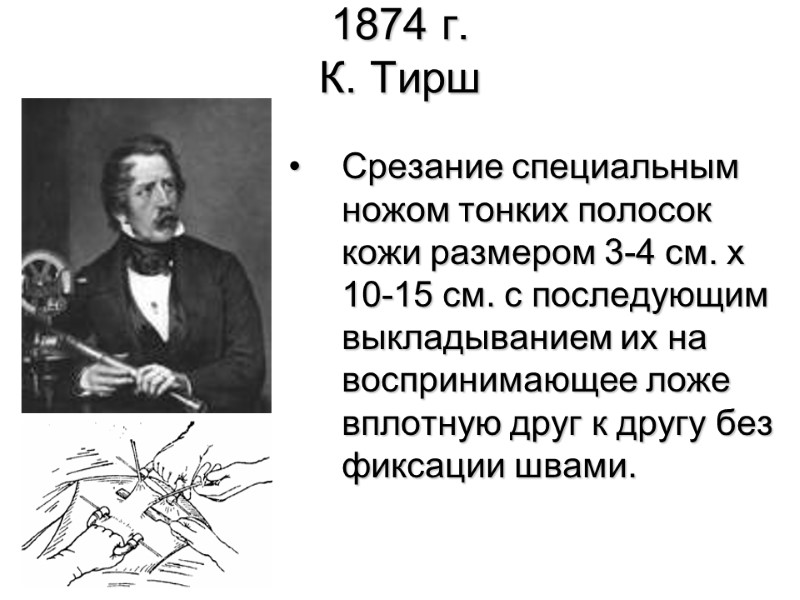 1874 г.  К. Тирш  Срезание специальным ножом тонких полосок кожи размером 3-4